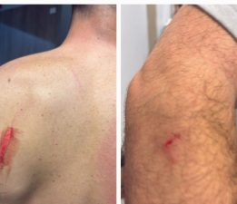 SANKİ SAVAŞTAN ÇIKMIŞ GİBİLER!